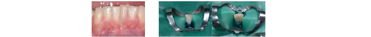 endodonzia