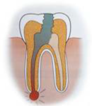 endodonzia