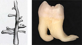 endodonzia