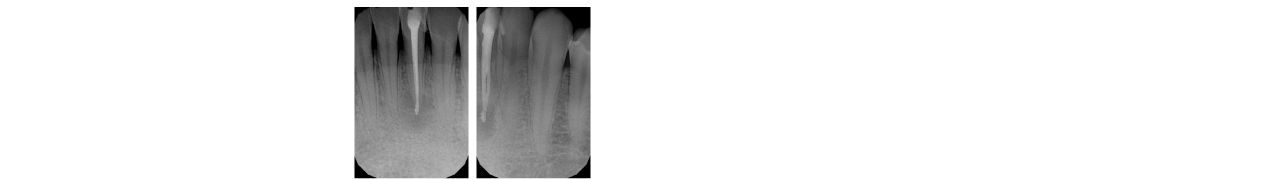 endodonzia