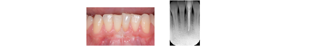 endodonzia